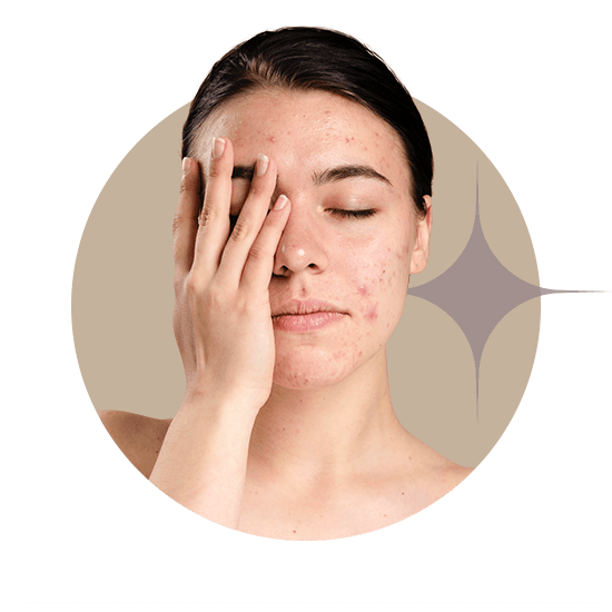 Проблемная и загрязненная кожа